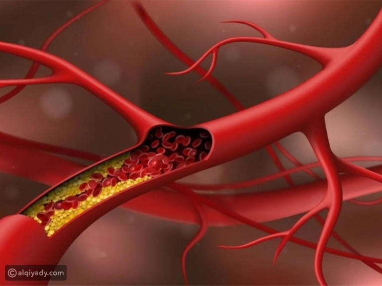 نصائح غذائية صحية لتخفيض الكوليسترول 1 AA1rAFcr