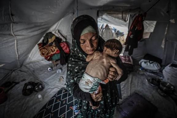 الصحة في غزة: ارتفاع إجمالي الوفيات جراء المجاعة في غزة إلى 422 شهيدا من بينهم 145 طفلا 2 IMG 0158