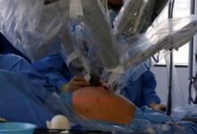 فاس تستعد لإطلاق نظام جراحة روبوتية متطور بتكلفة 39,6 مليون درهم 24 Photo dillustration Reuters