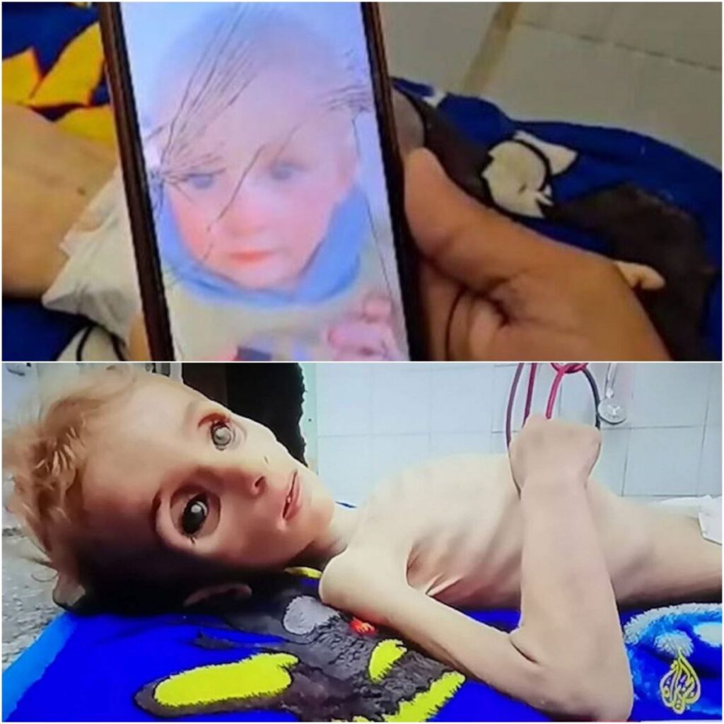 "الإعلام الحكومي" في قطاع غزة: توفي 69 طفلاً جوعاً في غزة، وارتفعت حصيلة ضحايا نقص الغذاء والدواء إلى 620 مريضاً. 2 photo 5465160543892536237 y