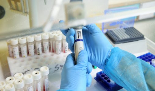 Nouveau projet425 508x300 1