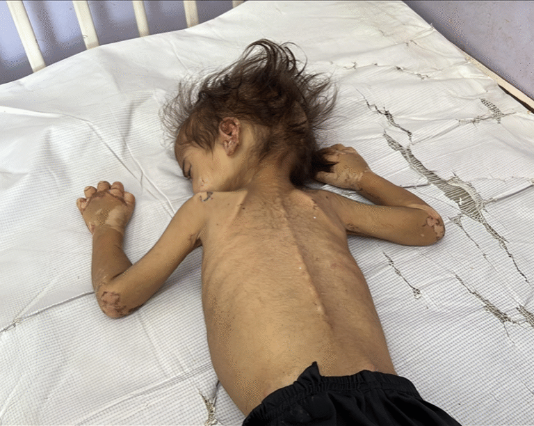 gaza