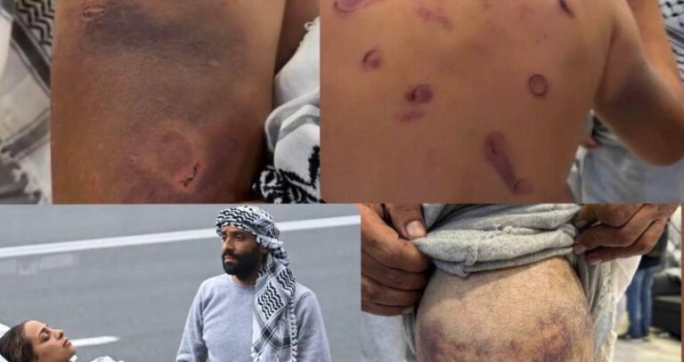 غزة