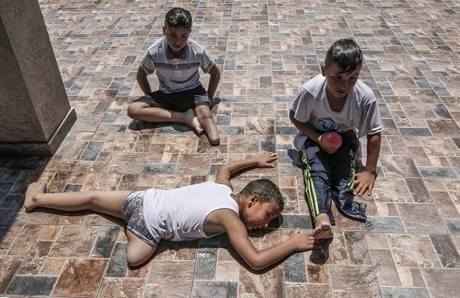 غزة..مركز متخصص: نقص الإمكانيات يضاعف مأساة 8000 شخص من مبتوري الأطراف