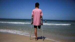 غزة..مركز متخصص: نقص الإمكانيات يضاعف مأساة 8000 شخص من مبتوري الأطراف 7 images 2026 08 09T194733.033