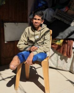 غزة..مركز متخصص: نقص الإمكانيات يضاعف مأساة 8000 شخص من مبتوري الأطراف 5 images 2026 08 09T194909.022