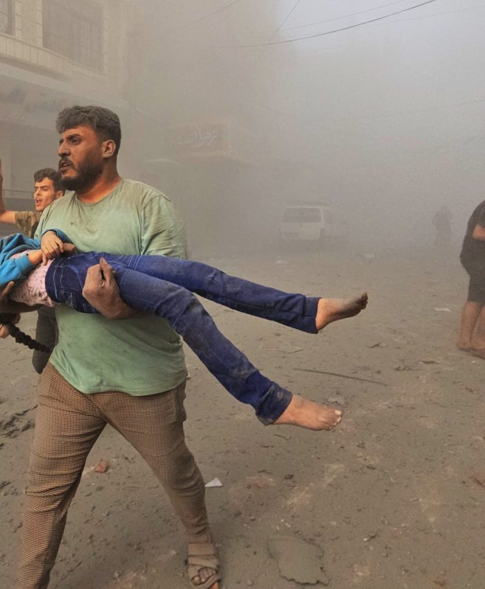 صحة غزة: 5 شهداء و8 جرحى وصلوا المستشفيات خلال الـ24 ساعة الماضية